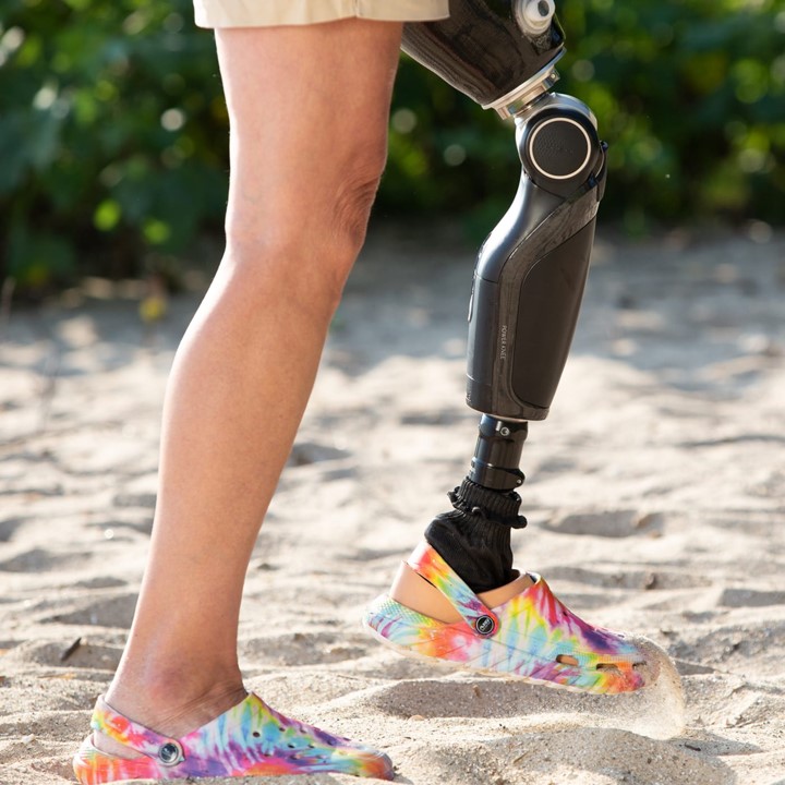 Knie
